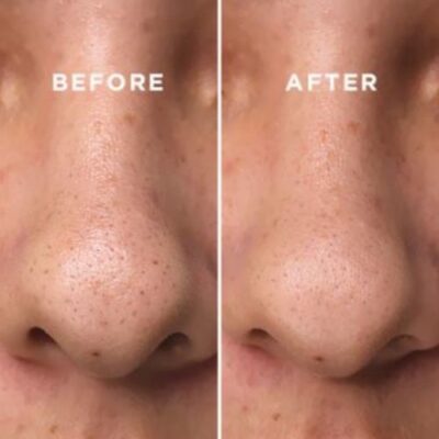 BHA BLACKHEAD POWER LIQUID