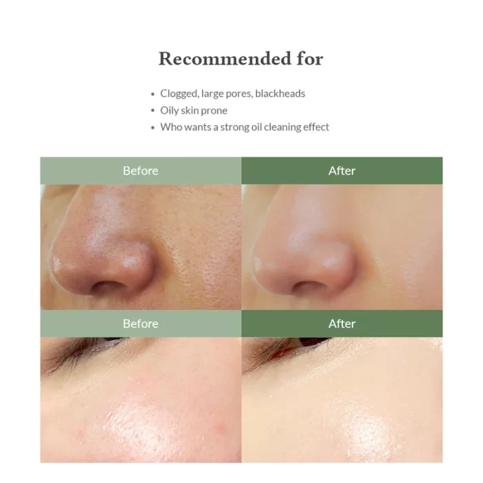 Premium Quick Step Sebum Cleanser - Imagen 2