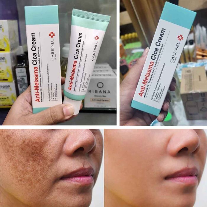 ANTI-MELASMA CICA CREAM - Imagen 2